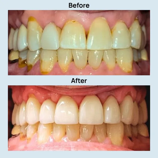 Dental Care at Lakeshore Family Dentistry in Oakland, California