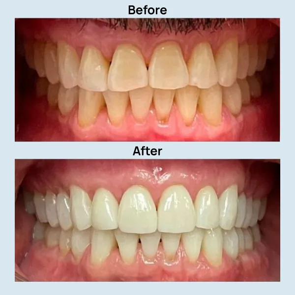 Dental Care at Lakeshore Family Dentistry in Oakland, California