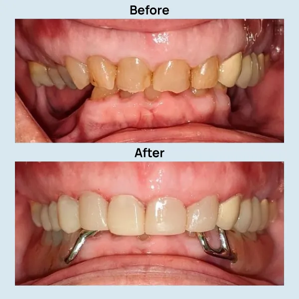 Dental Care at Lakeshore Family Dentistry in Oakland, California